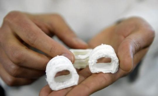3D yazıcı ile daha rahat nefes alan soluk borusu yaptılar
