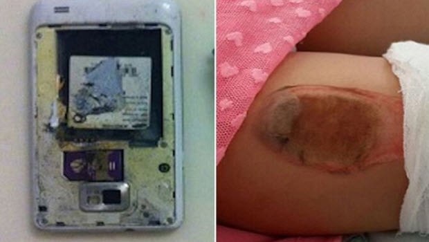 Galaxy S2 kız çocuğunun cebinde patladı