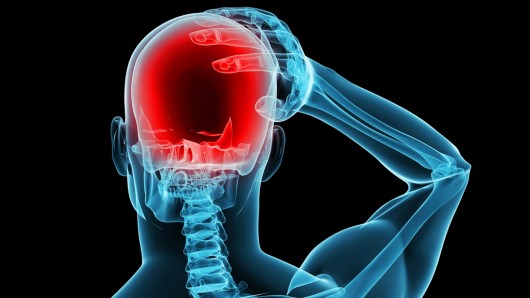 Migreni önleme ve azaltma bandı